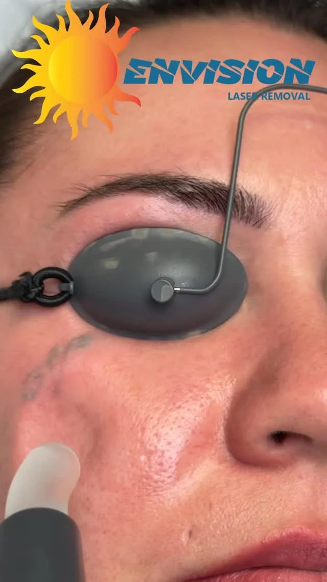 Happy Holidays Everyone 🦃 🎄 🎊#envisionlasertattooremoval #portcharlottefl #sarasota #permanentmakeupremoval #veniceflorida #arcadiafl