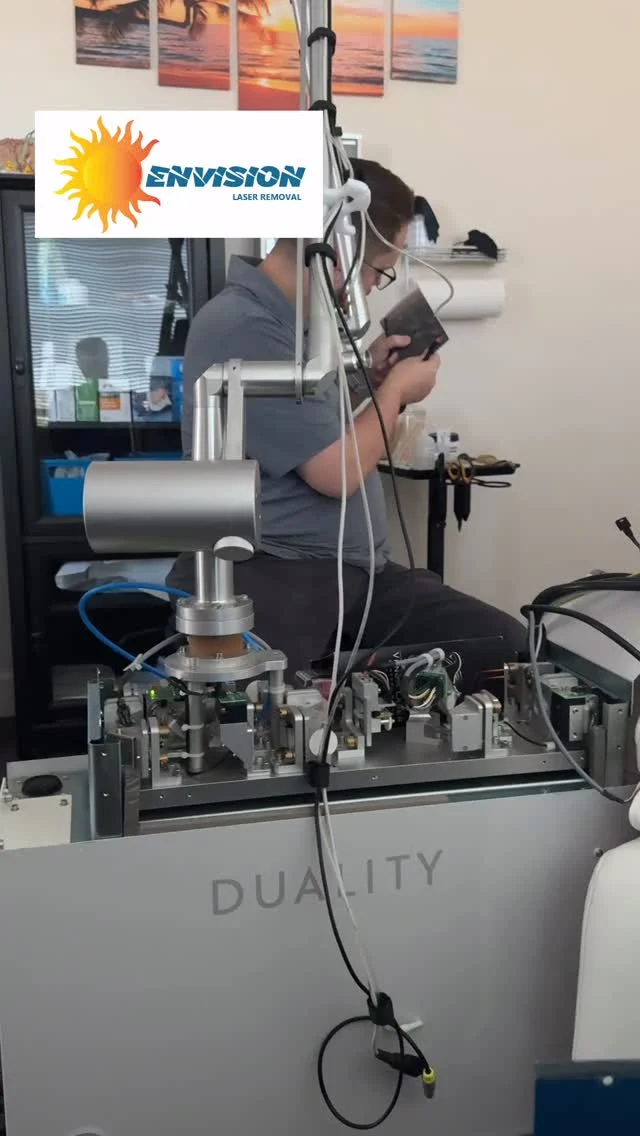 Laser Calibration and some treatments.  They say post much and often with authenticity?  The work should be complementary! But the satisfaction and completion helping other means more…#envisionlasertattooremoval #veniceflorida #portcharlottefl #fortmeyers #sarasota #tattooremovalbeforeandafter #permanentmakeupremoval #toenailfungus #englewoodfl #northportfl