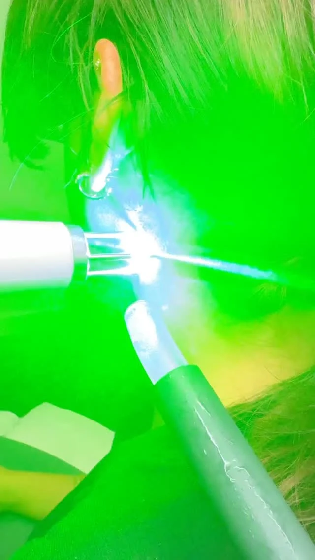 #tattooremoval Treatment #envisionlasertattooremoval #portcharlottefl #veniceflorida #sarasota