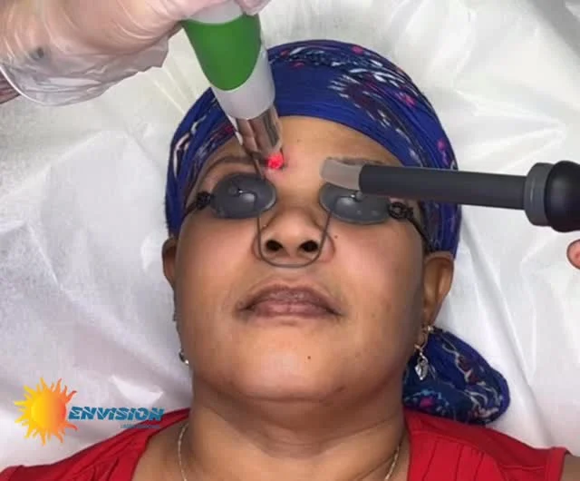 1st Laser Treatment #envisionlasertattooremoval #portcharlottefl #permanentmakeupremoval #sarasota #veniceflorida