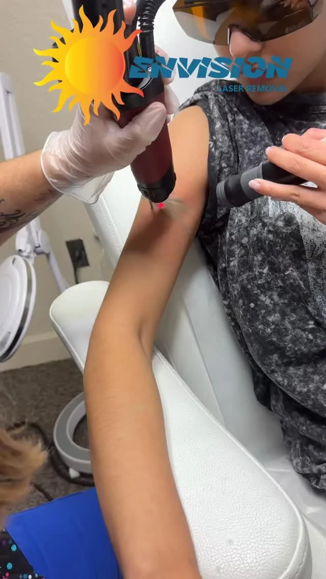 #envisionlasertattooremoval #portcharlottefl #sarasota #tattooremovalbeforeandafter #englewoodfl