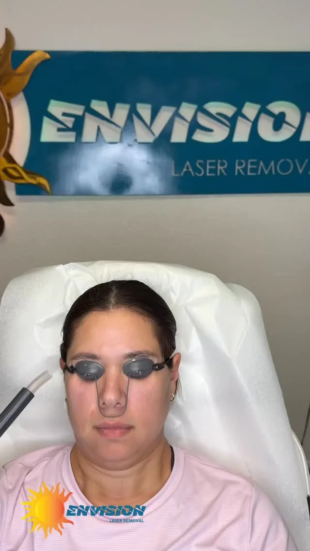 Laser Treatment #2 🟡&⚫️ #envisionlasertattooremoval 
#permanentmakeupremoval #portcharlottefl #sarasota
