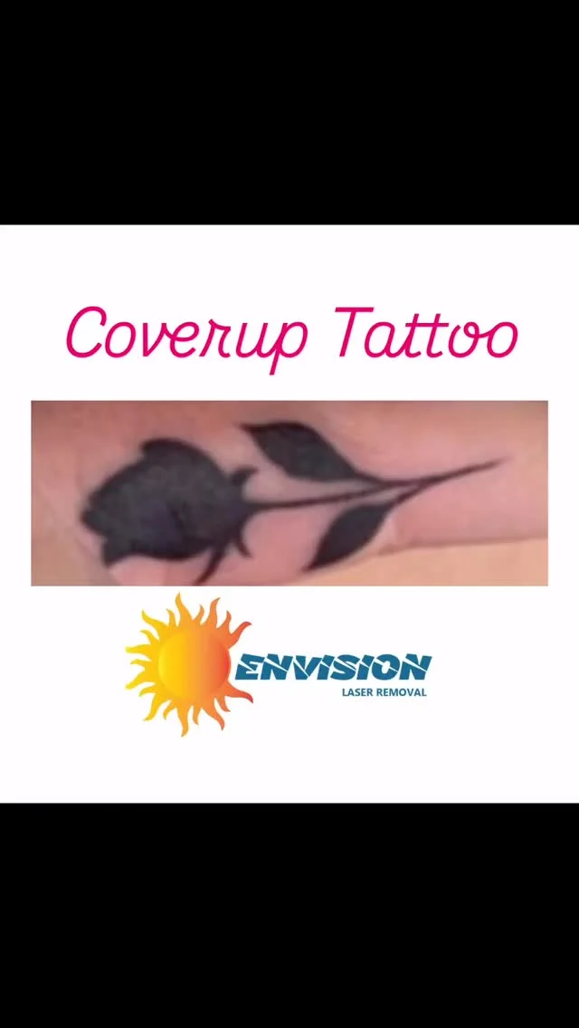 She wanted this coverup gone!🏎️. #envisionlasertattooremoval #tattooremovalbeforeandafter #portcharlottefl #sarasota #fortmeyers