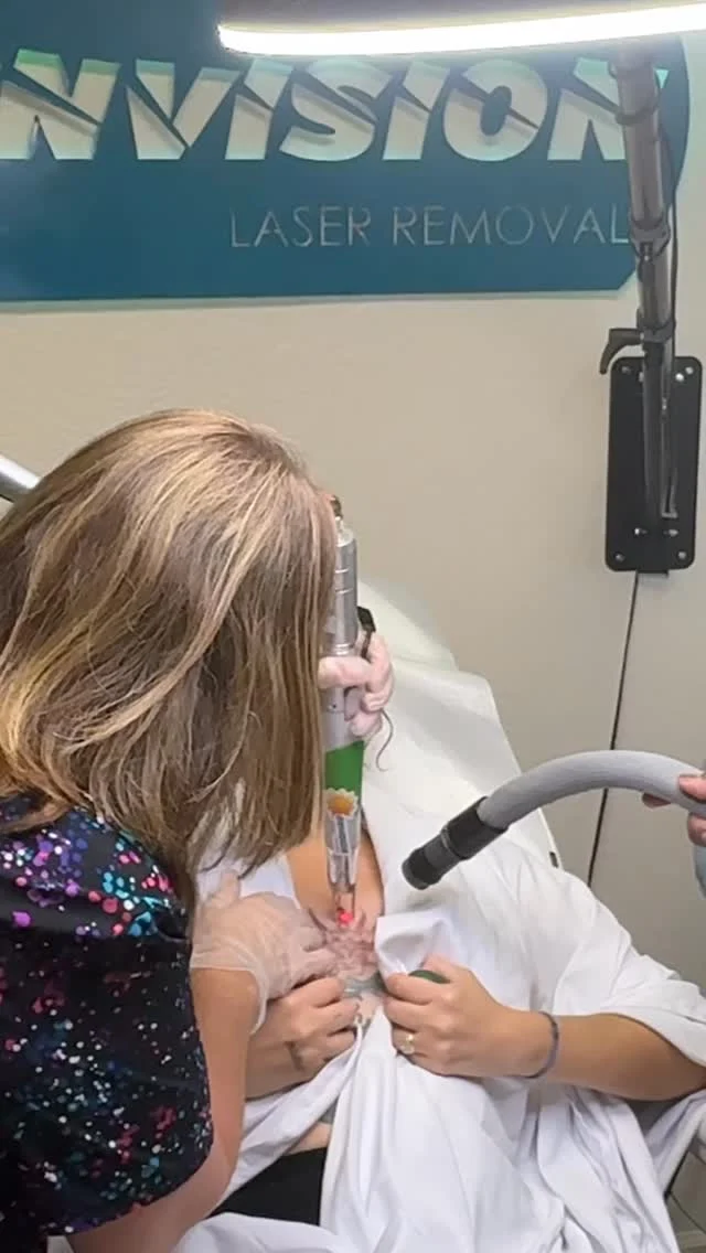 Her review:  Thank you to Eric and Ashley at Envision Laser! I was nervous about getting tattoo removal at first but they took the time to answer all of my questions and made the whole process a lot easier to understand. You can tell they truly care about their clients and provide a professional, comfortable environment. I was surprised at how quick the sessions are and they make sure you’re okay the entire time. I’m already seeing progress after just one session, which is amazing!! I would definitely recommend them to anyone considering tattoo removal!  Second laser treatment in progress with first treatment results pictured. #envisionlasertattooremoval #portcharlottefl #tattooremovalbeforeandafter #sarasota #capecoralflorida