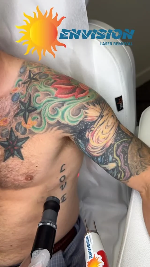 #envisionlasertattooremoval #portcharlottefl #sarasota #fortmeyers #veniceflorida