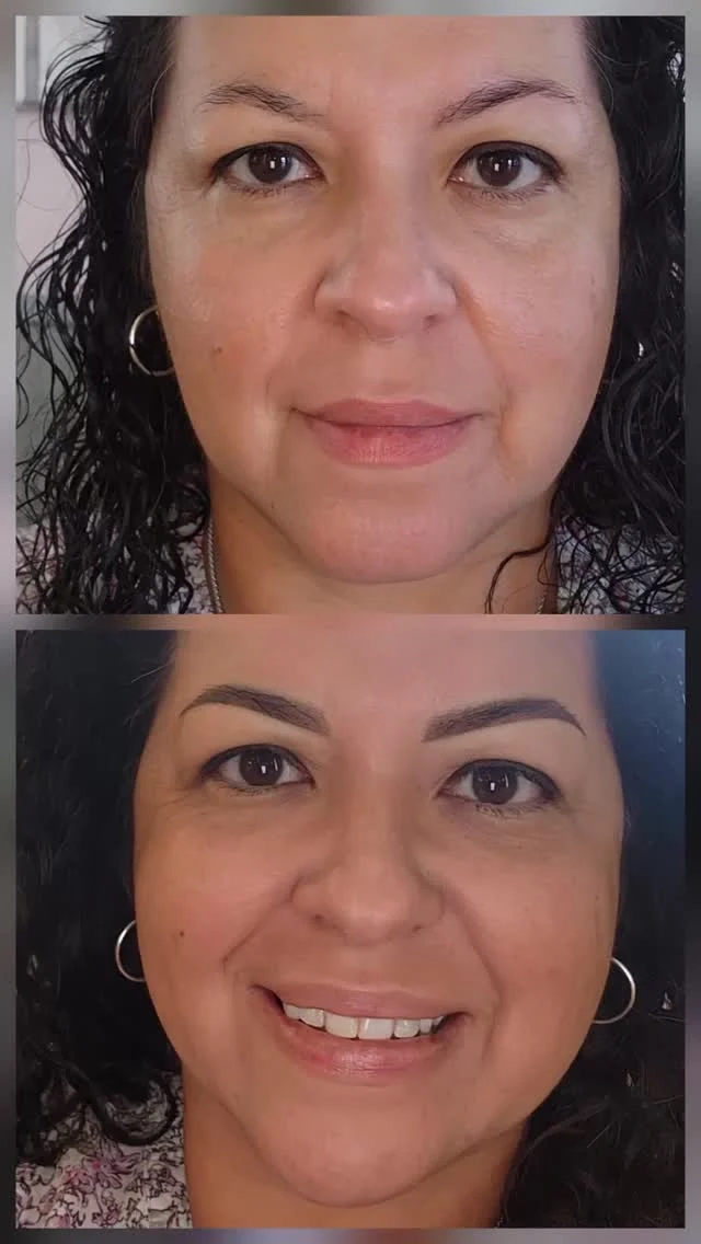 Two laser treatments, clear brows, then new browse.#envisionlasertattooremoval #portcharlottefl #veniceflorida #sarasota #permanentmakeupremoval