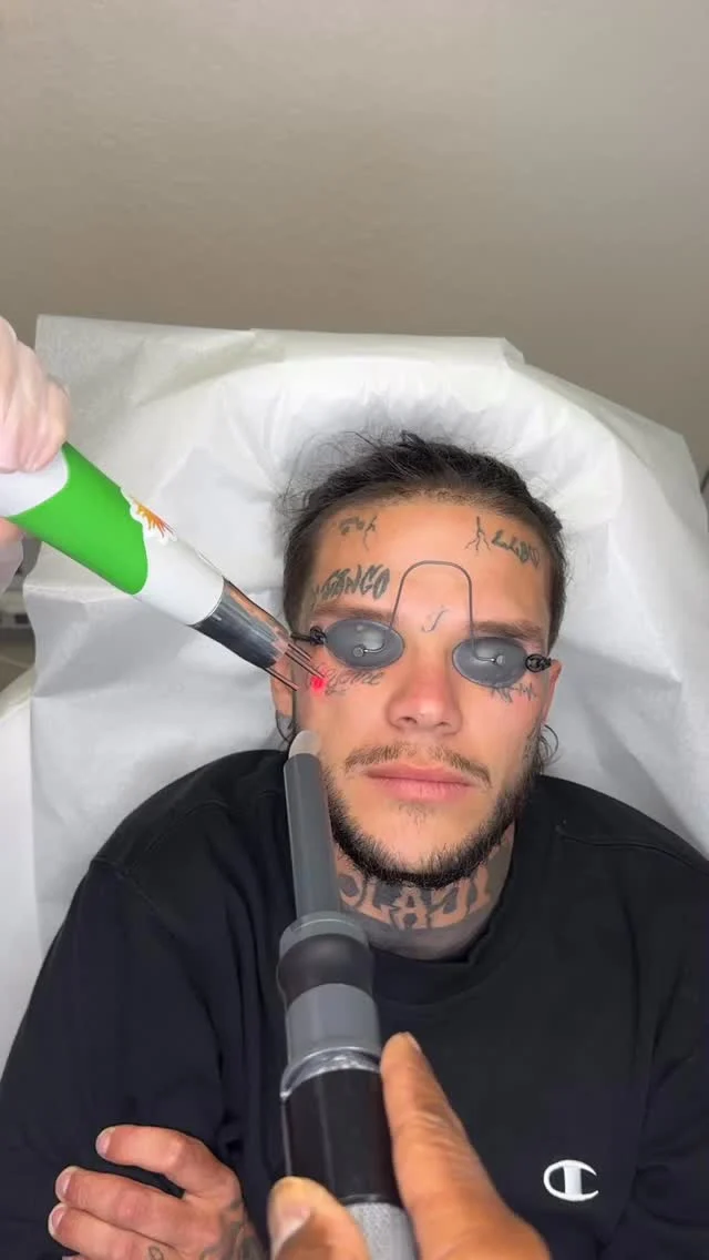 Why why #envisionlasertattooremoval #portcharlottefl #sarasota #tattooremovalbeforeandafter #englewoodfl