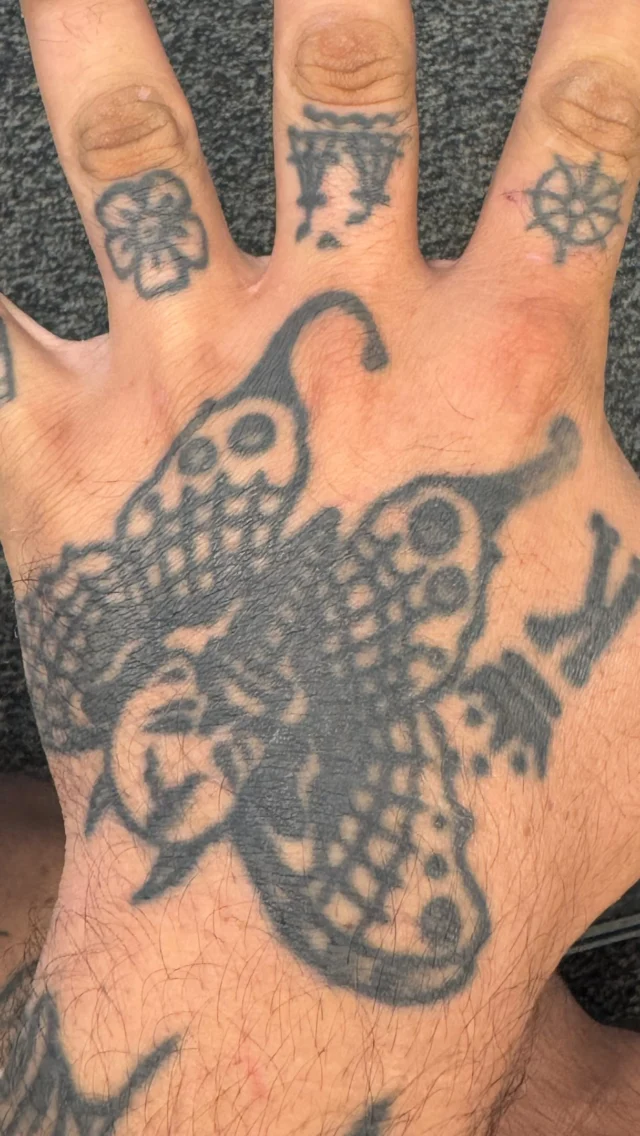 First laser treatment post consultation, 5 year back hand and fingers tattoo. He’s clearing the hand tattoos for the police department. #envisionlasertattooremoval #portcharlottefl #sarasota #englewoodfl #puntagordafl