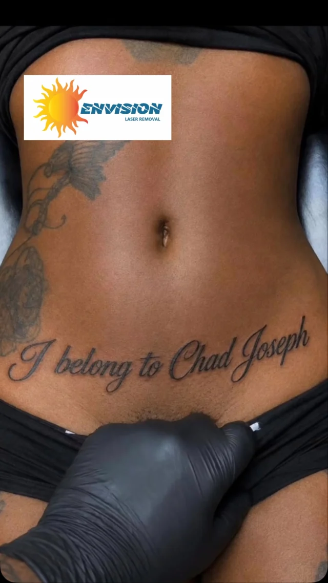All Skin Types I thru VI; All Ink Colors.  Our goal is removal as though it Never existed!  #envisionlasertattooremoval #portcharlottefl #tattooremovalbeforeandafter #permanentmakeupremoval  @followers @everyone @highlights