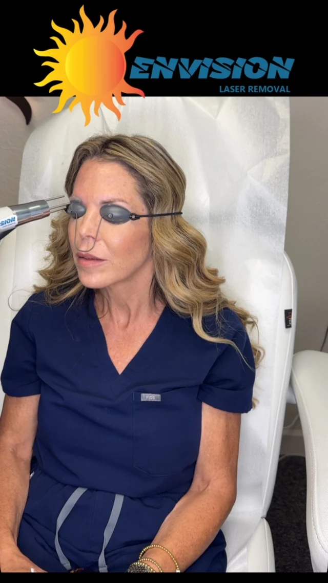 First laser treatment is complete and this is the second. She is seeking a reset and no more future ink. 🖋️ 🫟 #envisionlasertattooremoval #portcharlottefl #sarasota #permanentmakeupremoval #northportfl